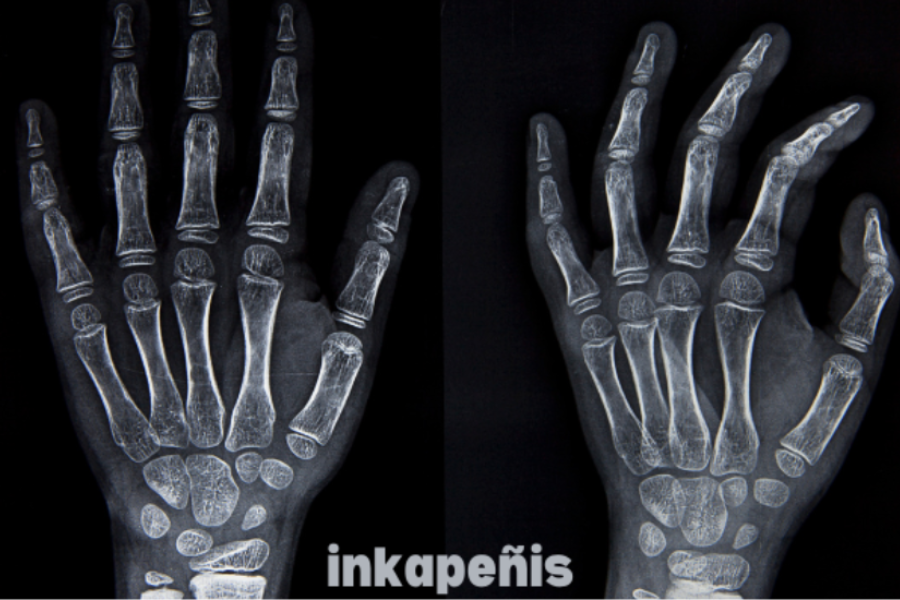 Inkapeñis Explained: How This Innovative Practice Enhances Your Life